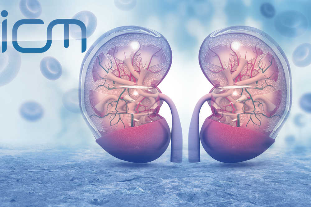Acute Kidney Injury in Sepsis