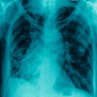 fello-medtronic-300x300