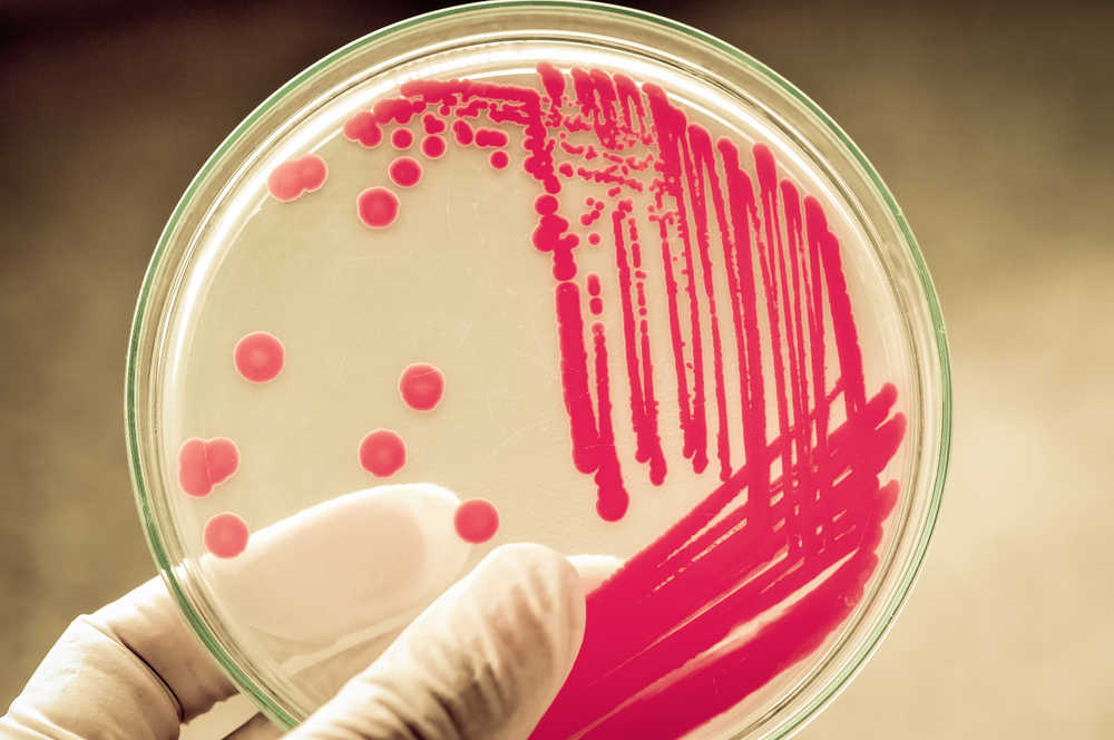 OPTIMISING INFECTION CARE