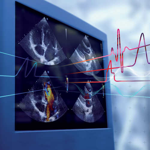 Advanced Course in IC Echocardiography