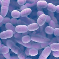 Pneumonia-Course Pneumonia-Course