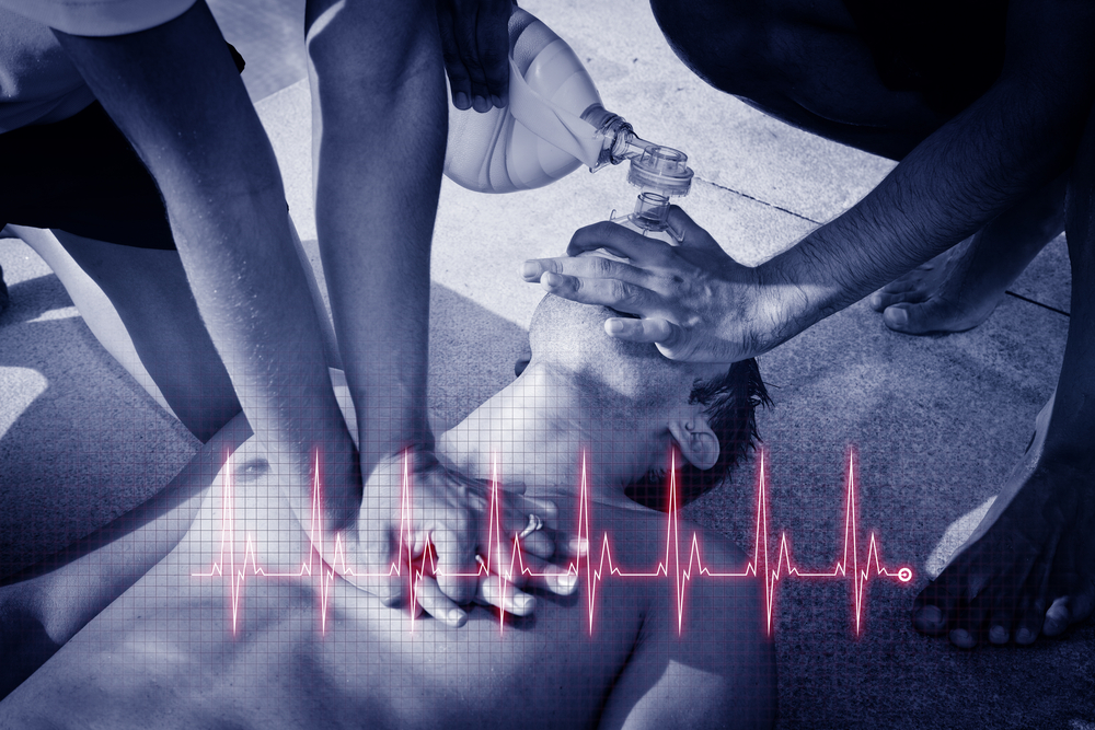 Chest Compression during CPR: Do ventilation interruptions really affect outcome?