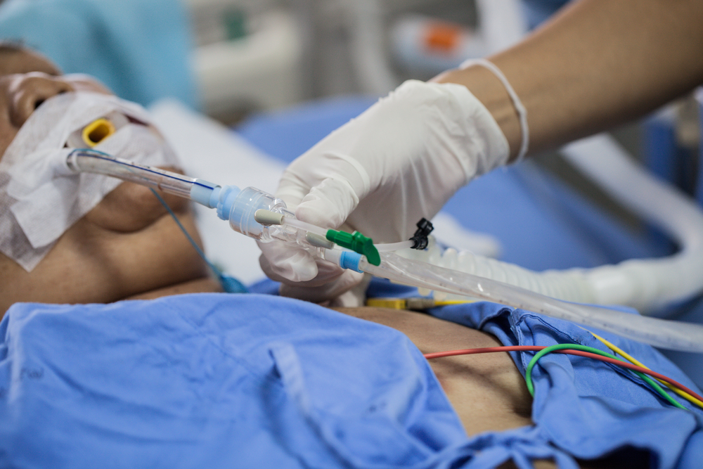Terminal weaning or immediate extubation: the ARREVE observational study