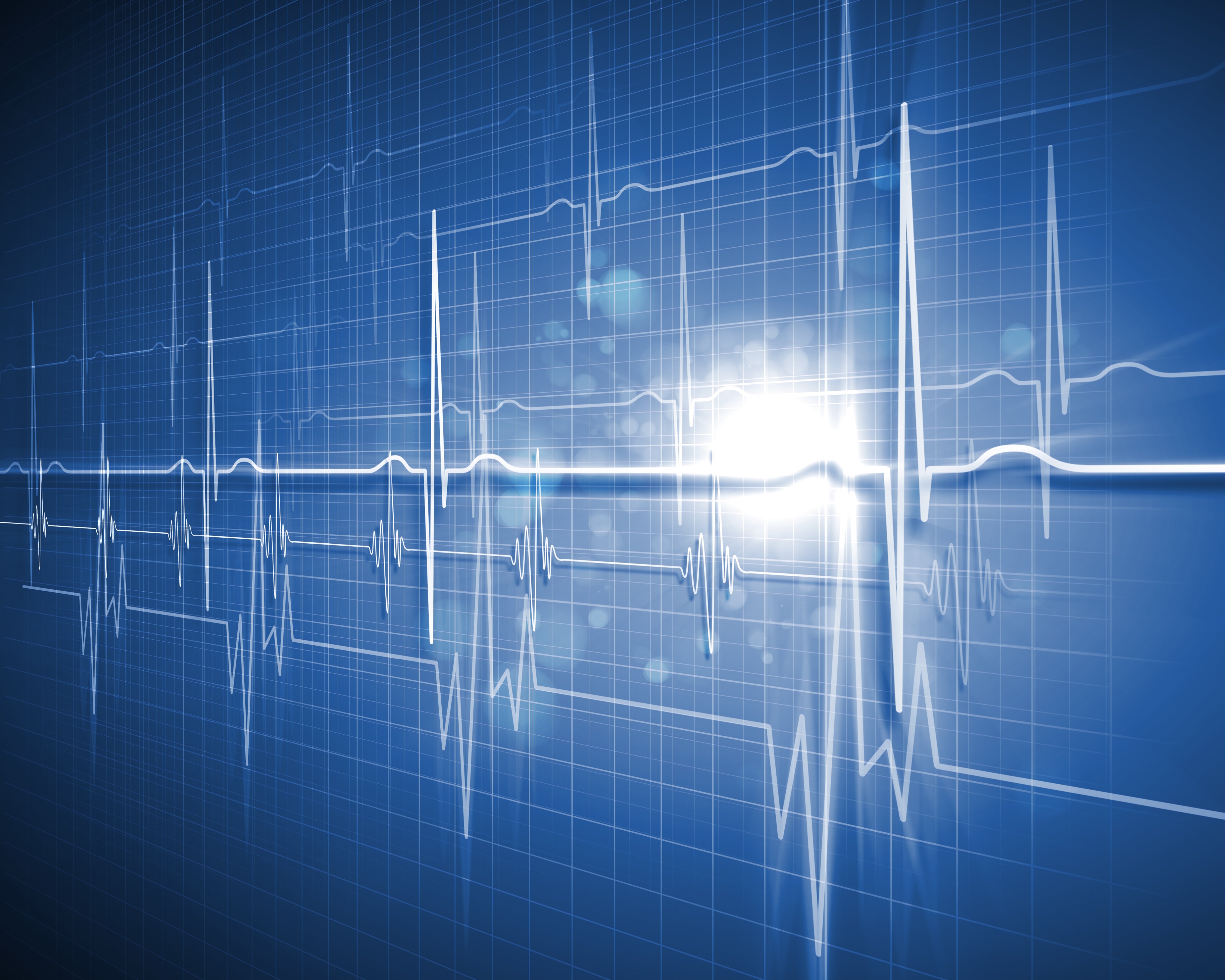 cEEG in the ICU: An effective tool at the bedside?