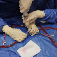 ECMO ECMO