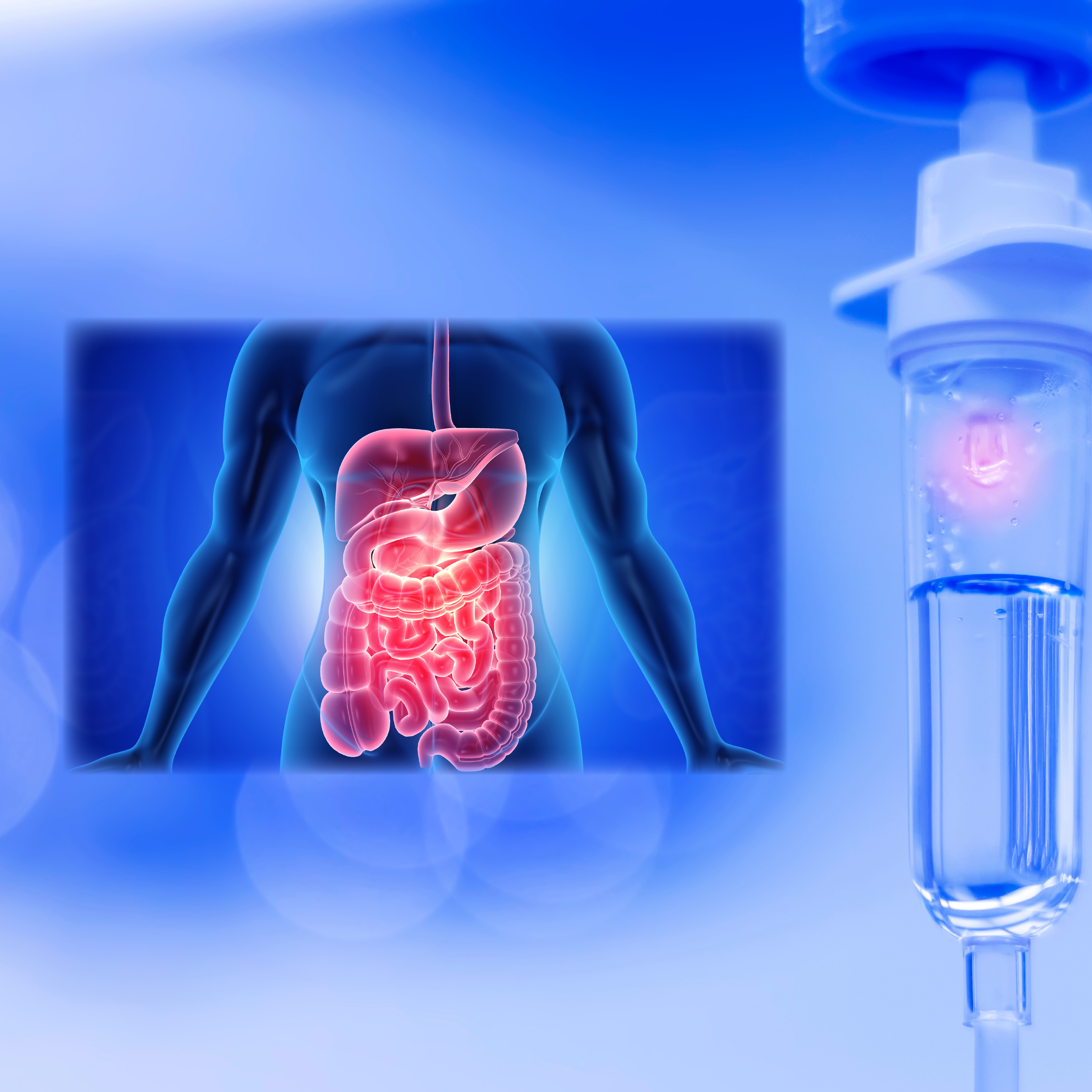 Nutrition in Critical Illness