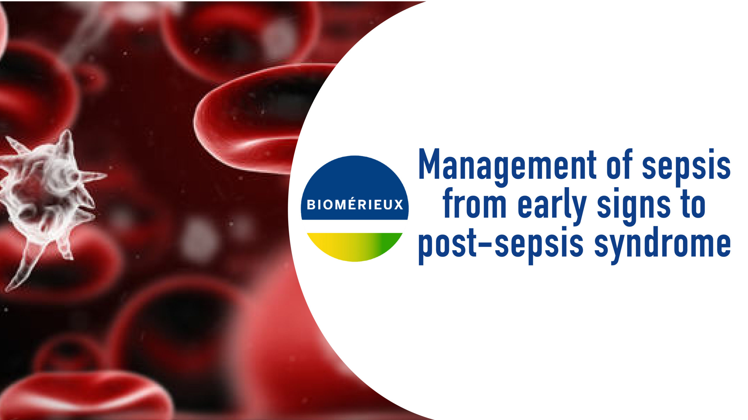 Educational webinar series sepsis management ESICM