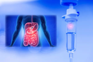 Nutrition in Critical Illness (April, 2025)